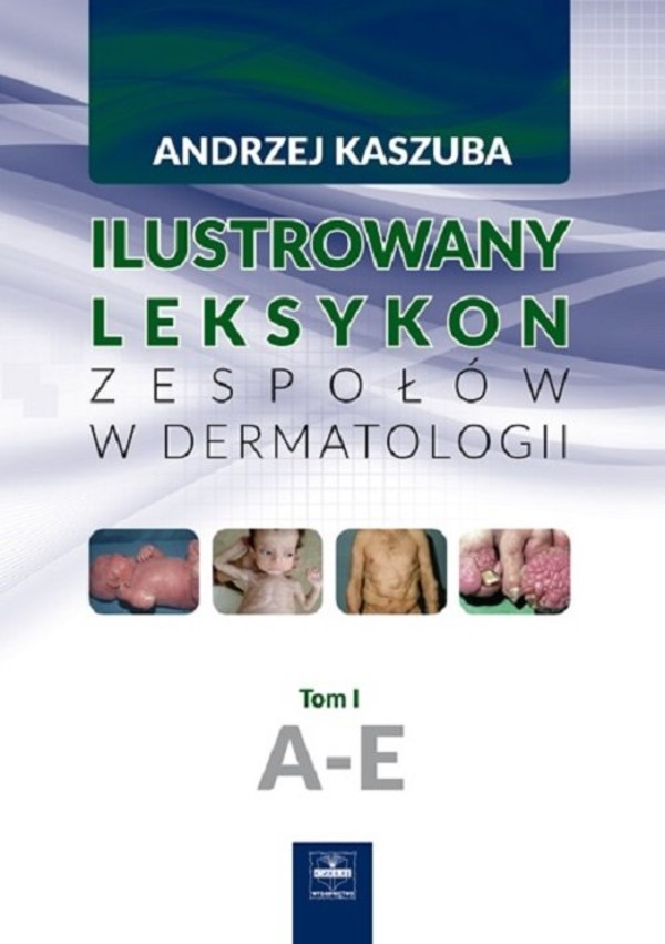 Ilustrowany leksykon zespołów w dermatologii Tom 1, A-E