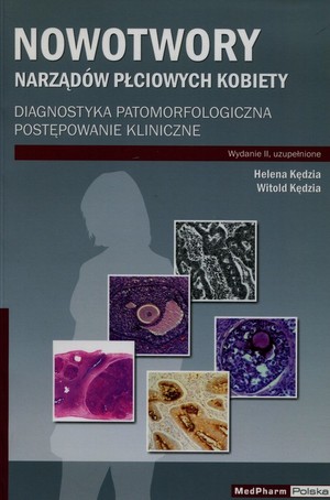 Nowotwory narządów płciowych kobiety Diagnostyka patomorfologiczna postępowanie kliniczne